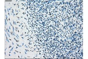 Immunohistochemical staining of paraffin-embedded colon tissue using anti-BUB1Bmouse monoclonal antibody. (BUB1B antibody)
