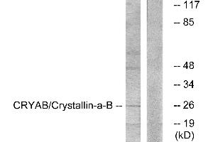 Western blot analysis of extracts from K562 cells, treated with Ca2+ (40nM, 30mins), using CRYAB/Crystallin-α-B (Ab-59) antibody. (CRYAB antibody)