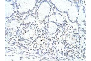 Image no. 1 for anti-Zinc Finger Protein 580 (ZNF580) (AA 31-80) antibody (ABIN6736331) (ZNF580 antibody  (AA 31-80))