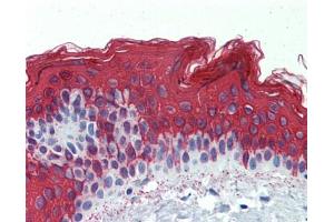 Immunohistochemistry (IHC) image for anti-Keratin 1 (KRT1) (Middle Region) antibody (ABIN2775333) (Cytokeratin 1 antibody  (Middle Region))