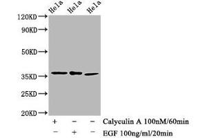 Western Blot Positive WB detected in Hela whole cell lysate(treated with Calyculin A or EGF) All lanes Phospho-EIF2S1 antibody at 1. (Recombinant EIF2S1 antibody  (pSer51))