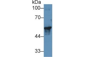 Western blot analysis of Pig Skin lysate, using Human KRT17 Antibody (1 µg/ml) and HRP-conjugated Goat Anti-Rabbit antibody (