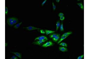 Immunofluorescent analysis of HepG2 cells using ABIN7153167 at dilution of 1:100 and Alexa Fluor 488-congugated AffiniPure Goat Anti-Rabbit IgG(H+L) (FFAR3 antibody  (AA 280-346))