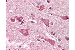 Anti-MYO1B / Myosin IB antibody IHC staining of human brain, cortex. (Myosin IB antibody  (AA 327-339))