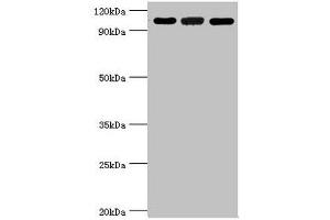 Western blot All lanes: 116 kDa U5 small nuclear ribonucleoprotein component antibody at 3 μg/mL Lane 1: Hela whole cell lysate Lane 2: 293T whole cell lysate Lane 3: NIH/3T3 whole cell lysate Secondary Goat polyclonal to rabbit IgG at 1/10000 dilution Predicted band size: 47, 44, 37 kDa Observed band size: 109 kDa (EFTUD2 antibody  (AA 1-205))