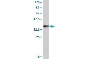 Western Blot detection against Immunogen (37. (MRAP antibody  (AA 69-172))