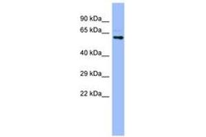 Image no. 1 for anti-Cytochrome P450, Family 4, Subfamily A, Polypeptide 22 (CYP4A22) (AA 35-84) antibody (ABIN6741748)