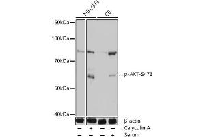 Western blot analysis of extracts of various cell lines, using Phospho-Akt-S473 antibody (ABIN7265523) at 1:1000 dilution. (AKT 1/2/3 antibody  (pSer472))