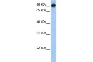 Western Blotting (WB) image for anti-SATB Homeobox 1 (SATB1) antibody (ABIN2460703) (SATB1 antibody)
