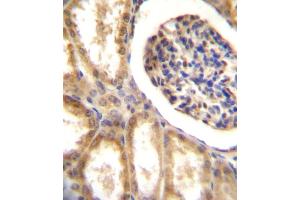 DDR1 Antibody (N-term) A immunohistochemistry analysis in formalin fixed and paraffin embedded human kidney tissue followed by peroxidase conjugation of the secondary antibody and DAB staining. (DDR1 antibody  (N-Term))