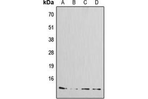 Western blot analysis of Amylin expression in MCF7 (A), HeLa (B), mouse kidney (C), rat kidney (D) whole cell lysates. (Amylin/DAP antibody  (N-Term))