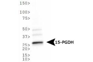 Image no. 2 for anti-Hydroxyprostaglandin Dehydrogenase 15-(NAD) (HPGD) antibody (ABIN363465) (HPGD antibody)