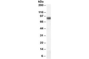Western blot testing of human liver lysate with CPT1A antibody at 0.