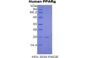 SDS-PAGE analysis of Human PPARG Protein.