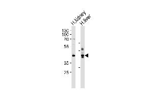 Western blot analysis of lysates from human kidney and liver tissue lysate (from left to right), using SEPT9 Antibody at 1:1000 at each lane.