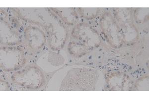 Detection of TAGLN2 in Human Kidney Tissue using Polyclonal Antibody to Transgelin 2 (TAGLN2) (TAGLN2 antibody  (AA 2-199))