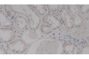 Detection of TAGLN2 in Human Kidney Tissue using Polyclonal Antibody to Transgelin 2 (TAGLN2)