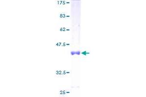 MED31 Protein (AA 1-131) (GST tag)