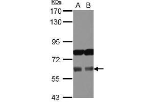 WB Image Sample (30 ug of whole cell lysate) A: 293T B: A431 7. (Adracalin antibody  (Internal Region))