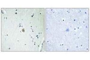Immunohistochemistry analysis of paraffin-embedded human brain tissue, using Cytochrome P450 2E1 antibody. (CYP2E1 antibody  (C-Term))