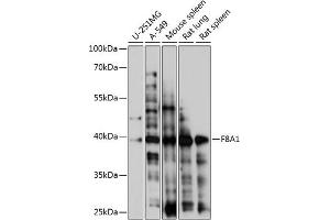 Western blot analysis of extracts of various cell lines, using F8 antibody (4806) at 1:1000 dilution. (Coagulation Factor VIII-Associated 1 (F8A1) (AA 150-250) antibody)