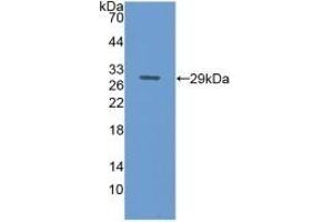 Detection of Recombinant TFR, Mouse using Polyclonal Antibody to Transferrin Receptor (TFR) (Transferrin Receptor antibody  (AA 572-757))