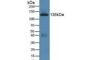 Detection of JAG1 in Rat Uterus Tissue using Polyclonal Antibody to Jagged 1 (JAG1) (JAG1 antibody  (AA 470-834))