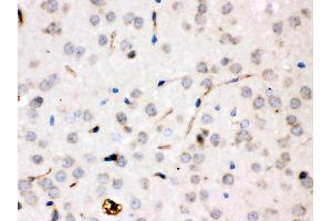 Ceruloplasmin was detected in paraffin-embedded sections of rat brain tissues using rabbit anti- Ceruloplasmin Antigen Affinity purified polyclonal antibody at 1 μg/mL. (Ceruloplasmin antibody  (AA 20-258))