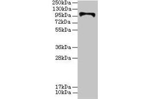 HKDC1 antibody  (AA 129-427)