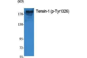 Western Blotting (WB) image for anti-Tensin 1 (TNS1) (pTyr1326) antibody (ABIN3183066) (Tensin 1 antibody  (pTyr1326))