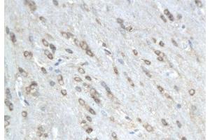 Formalin-fixed and paraffin embedded rat colitis labeled with Anti-phospho-MAP4(Ser941) Polyclonal Antibody, Unconjugated  followed by conjugation to the secondary antibody and DAB staining