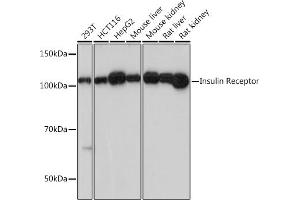 Western blot analysis of extracts of various cell lines, using Insulin Receptor antibody (ABIN7267889) at 1:1000 dilution. (Insulin Receptor antibody)