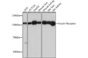 Western Blotting (WB) image for anti-Insulin Receptor (INSR) antibody (ABIN7267889)