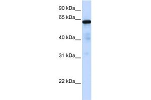 WB Suggested Anti-FOXN4 Antibody Titration:  0. (FOXN4 antibody  (C-Term))