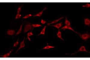 ABIN6275161 staining LOVO by IF/ICC. (GHITM antibody  (N-Term))