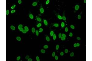 Immunofluorescence staining of Hela cells with ABIN7139181 at 1:10, counter-stained with DAPI. (H2AFZ antibody  (acLys4))