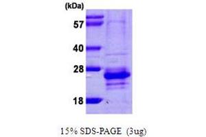 CABP7 Protein (AA 1-188) (His tag)