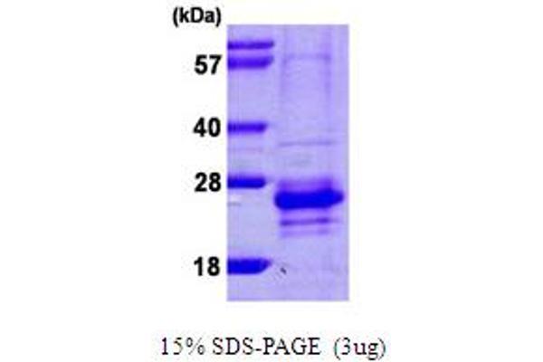 CABP7 Protein (AA 1-188) (His tag)