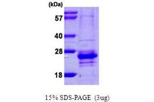 SDS-PAGE (SDS) image for Calcium Binding Protein 7 (CABP7) (AA 1-188) protein (His tag) (ABIN667433)