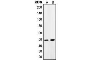 Western blot analysis of PDK1 expression in LNCaP (A), A431 (B) whole cell lysates. (PDPK1 antibody  (Center))