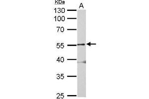 WB Image Glycine Receptor alpha 2 antibody detects GLRA2 protein by Western blot analysis. (GLRa2 antibody)