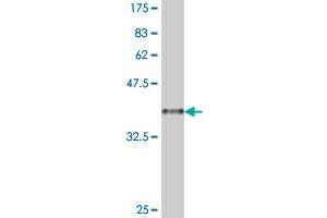 Western Blot detection against Immunogen (38. (MBD3 antibody  (AA 70-179))