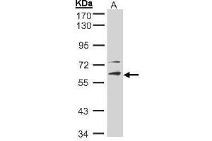 WB Image Sample(30 ug whole cell lysate) A:Hep G2 , 10% SDS PAGE antibody diluted at 1:2000 (STK33 antibody)