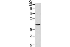 Gel: 8 % SDS-PAGE,Lysate: 40 μg,Primary antibody: ABIN7191352(MAGEB3 Antibody) at dilution 1/200 dilution,Secondary antibody: Goat anti rabbit IgG at 1/8000 dilution,Exposure time: 10 seconds (MAGEB3 antibody)