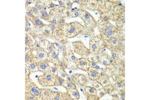 Immunohistochemistry of paraffin-embedded human liver injury using GLUD2 antibody at dilution of 1:100 (x40 lens).