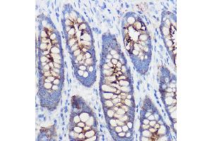 Immunohistochemistry (IHC) image for anti-Polymeric Immunoglobulin Receptor (PIGR) (AA 661-764) antibody (ABIN6145618)