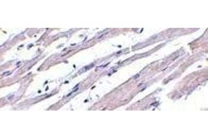 Immunohistochemistry of Apaf1 in human heart tissue with Apaf1 (NT) antibody at 1μg/ml. (APAF1 antibody  (N-Term))