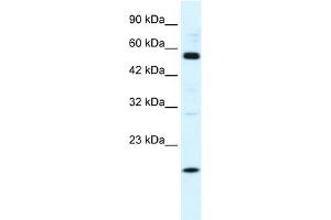 WB Suggested Anti-ZNF436 Antibody Titration:  1. (ZNF436 antibody  (N-Term))