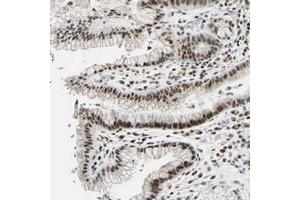 Immunohistochemical staining of human stomach with C1orf174 polyclonal antibody  shows moderate nuclear positivity in glandular cells. (C1orf174 antibody)