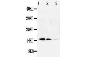 Anti-Galectin 1 antibody, Western blotting Lane 1: Recombinant Human Galeactin-1 Protein 10ng Lane 2: Recombinant Human Galeactin-1 Protein 5ng Lane 3: Recombinant Human Galeactin-1 Protein 2.